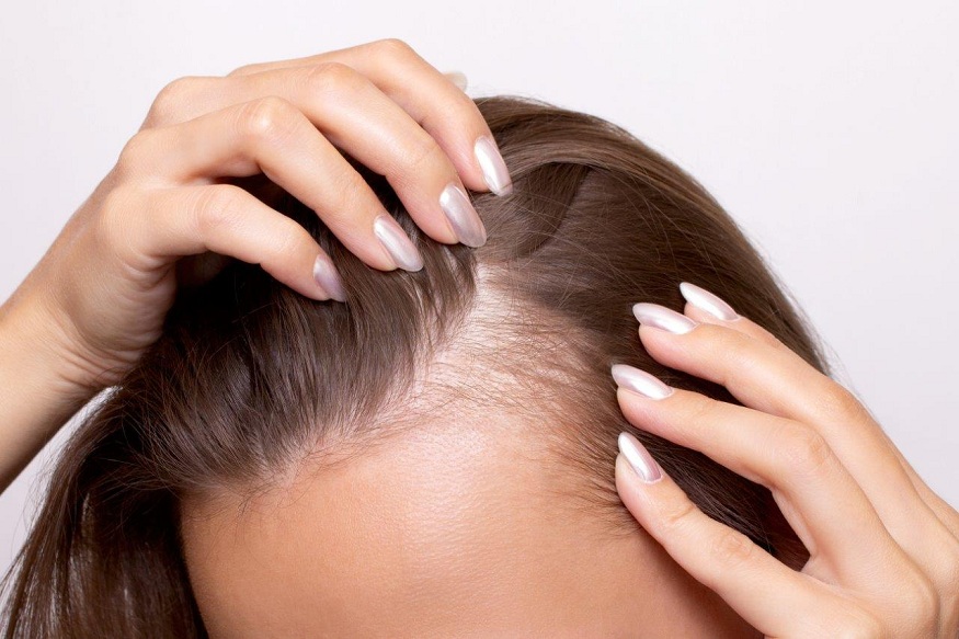 Hair loss: causes, treatment and prevention